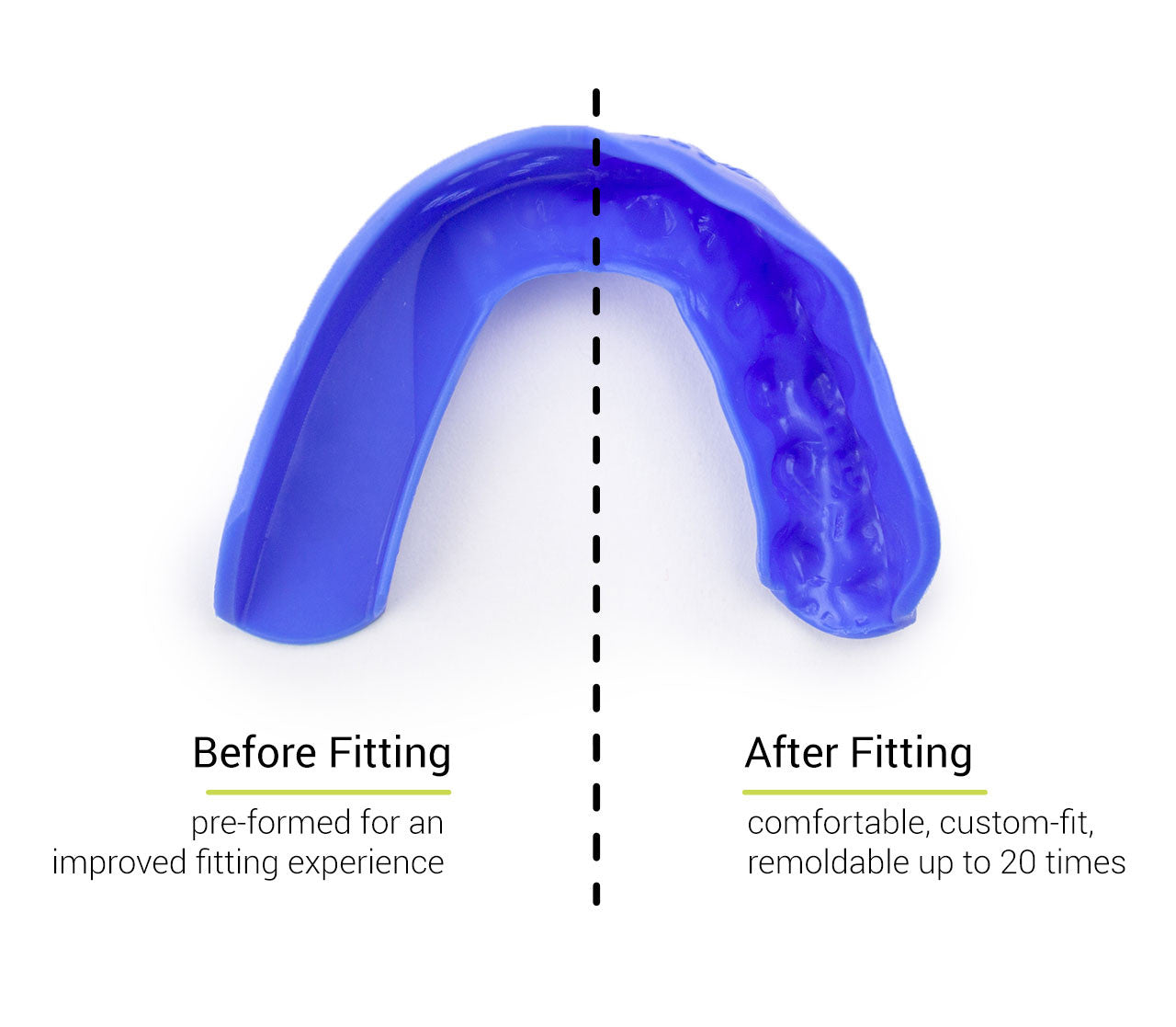 SISU 3D™ - protector bucal premoldeado • varios colores